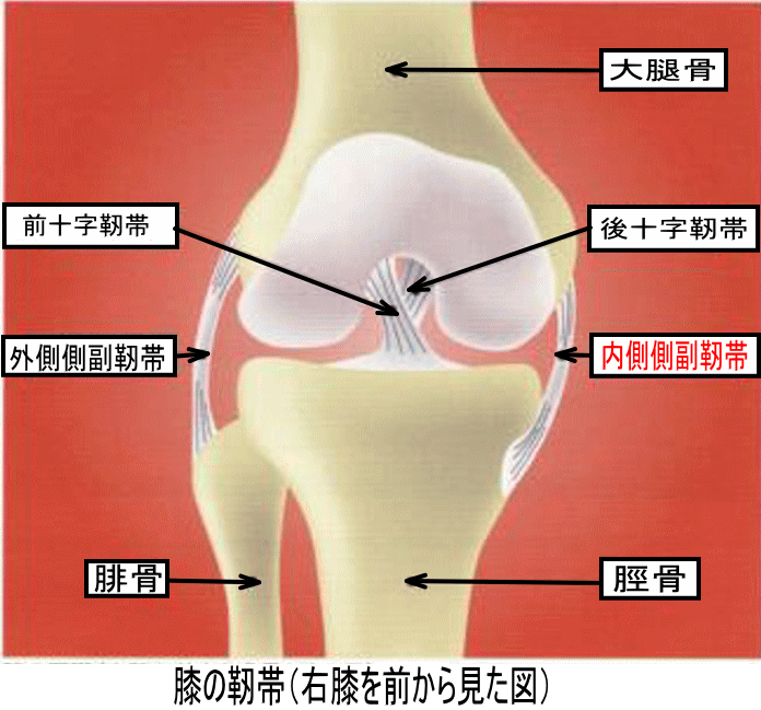 内側側副靭帯損傷