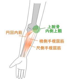 内側上顆炎